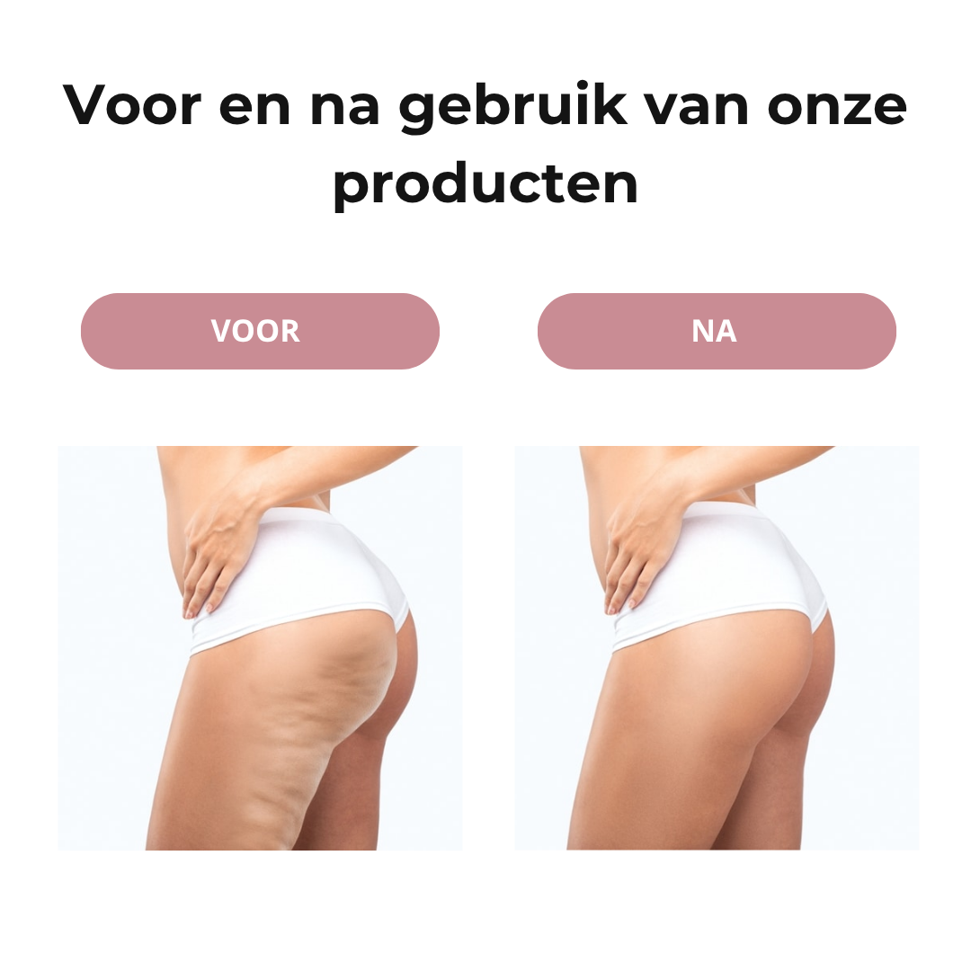 DermaSculpt™ 3-in-1 Cellulite Massager